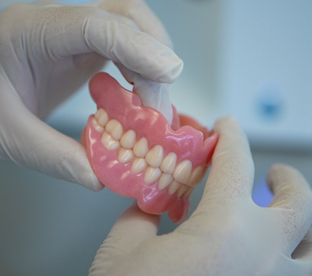 3D Druck Dental Modell.