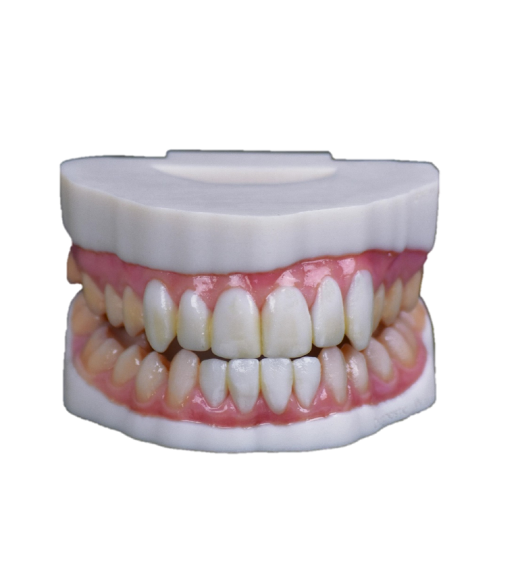 3D-Druck Stratasys Polyjet Dental 3D-Druck Kiefer Model.