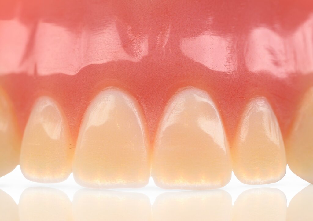 Stratasys TrueDent PolyJet Technologie Dental Dentallabor Zahnmedizin Monolithisch Prothese.