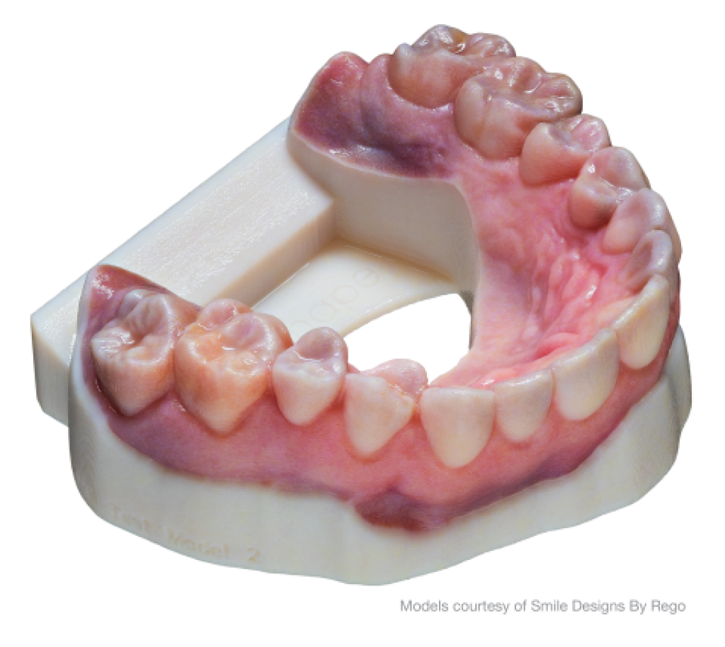 Vollfarb Modell Stratasys J5 DentaJet Dental.