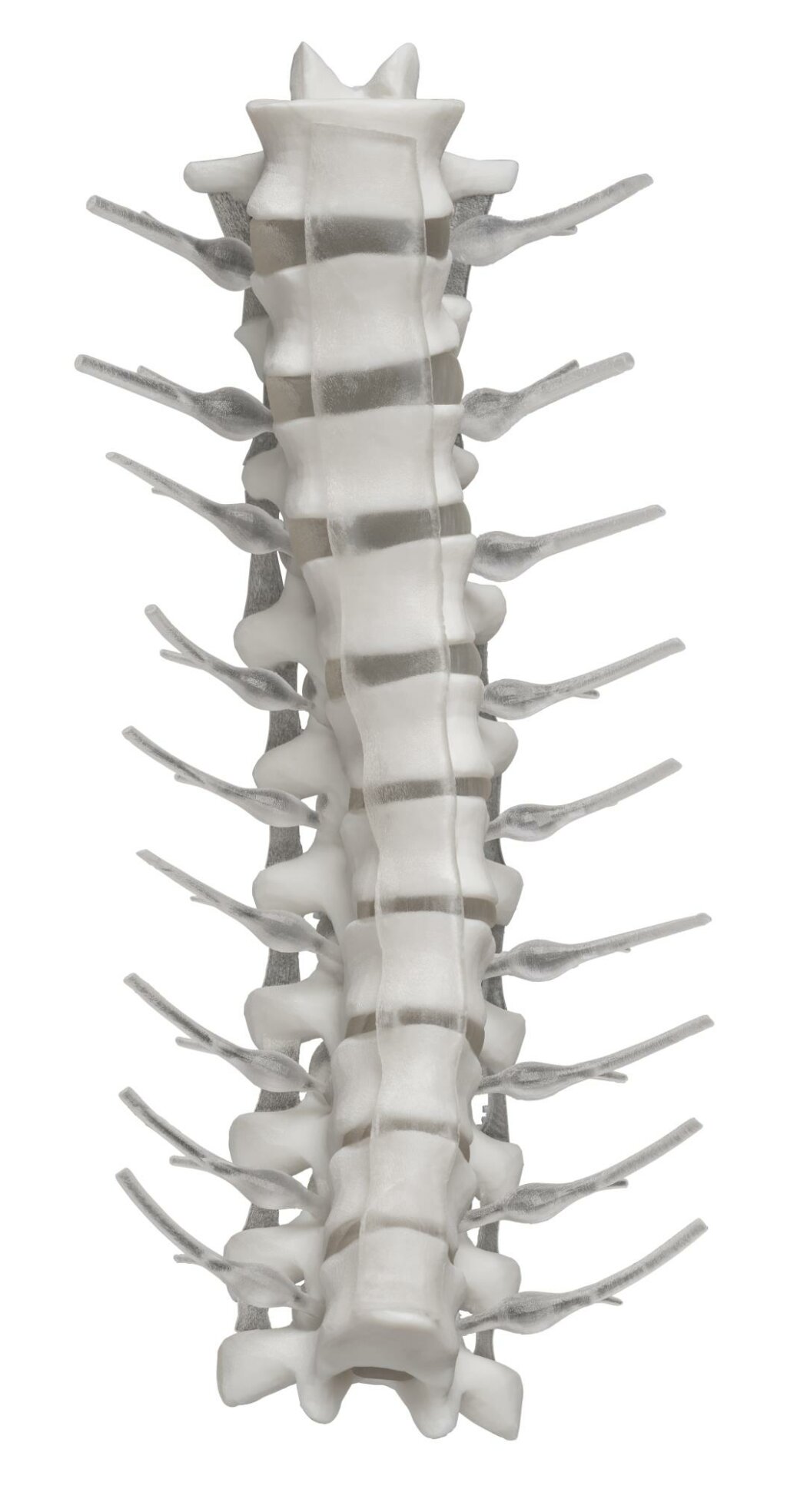 Stratasys 3D Druck Medizin Wirbekläule mit Bandscheiben. Anatomie 3D Druck J850 3D Drucker.